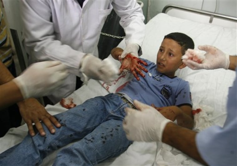 A injured Palestinian schoolboy receives treatment at "Al Najar" hospital in the southern Gaza strip town of Rafah on Wednesday.